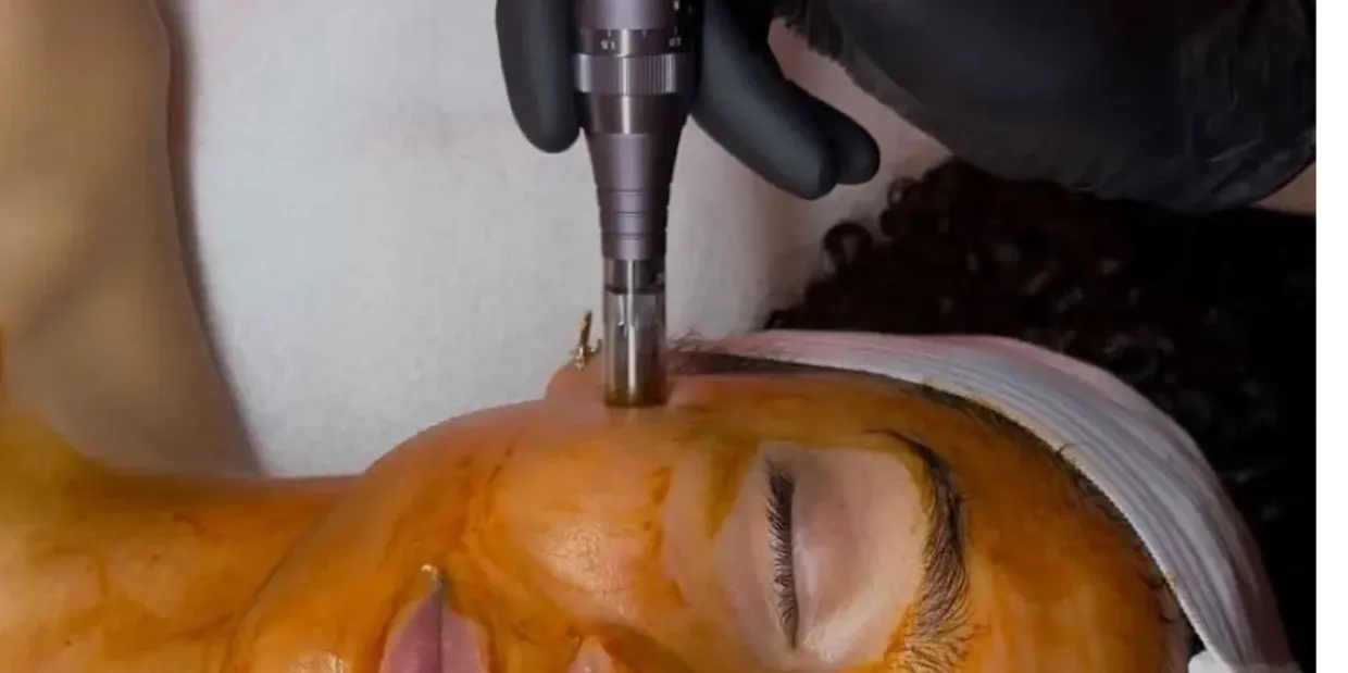 RevitaPen Microcurrent Facial Treatment